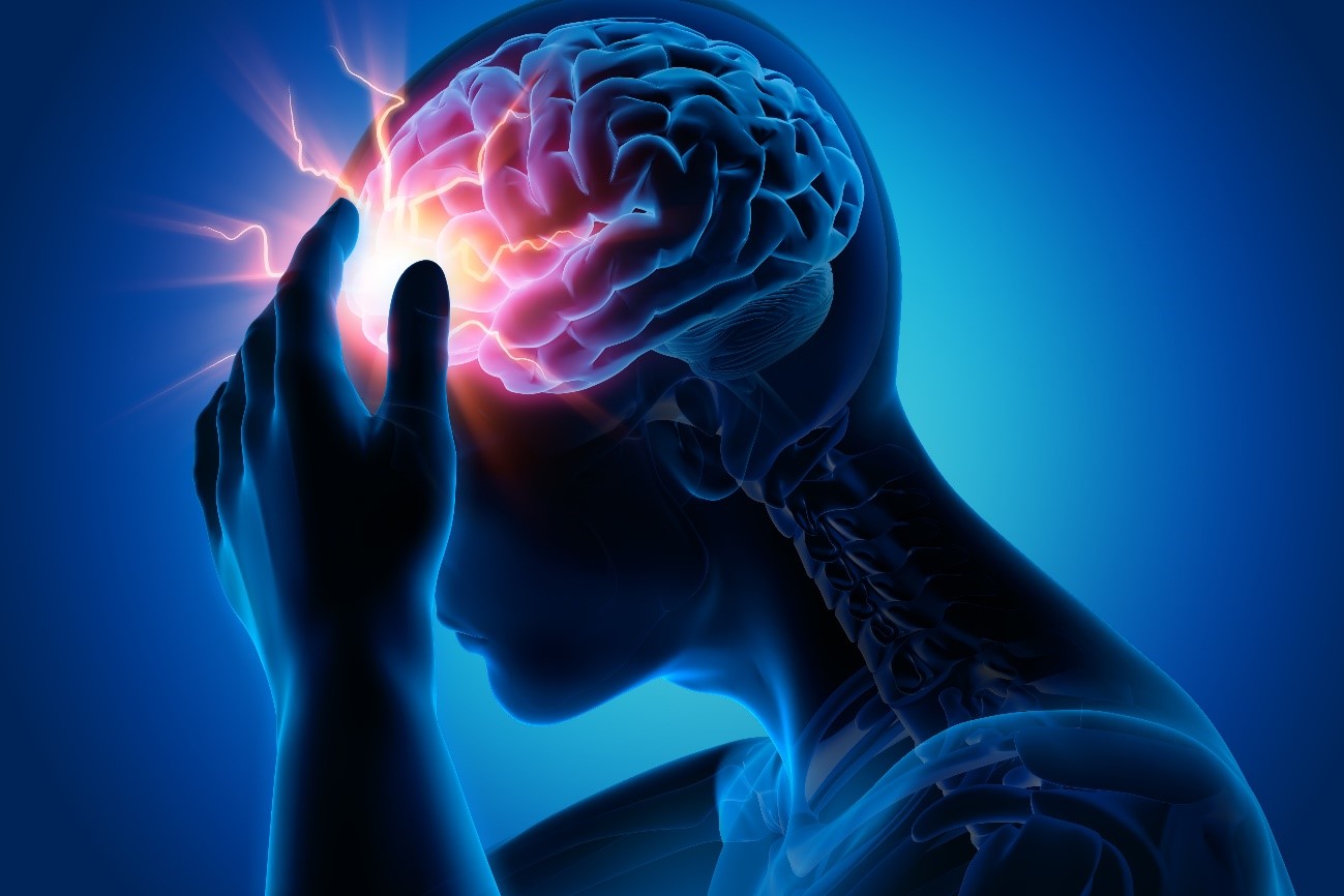レビトラジェネリック（バルデナフィル）の副作用に頭痛薬を使う際の注意点