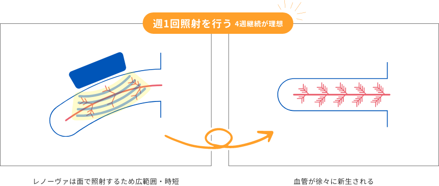 週1回照射を行う 4週継続が理想