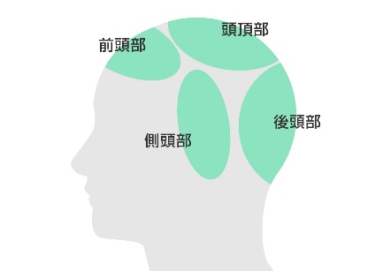部位から見る薄毛の原因