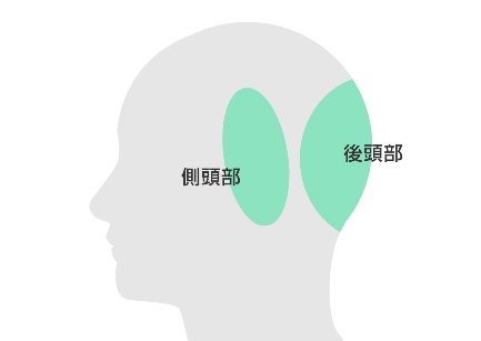 側頭部・後頭部が薄毛の場合