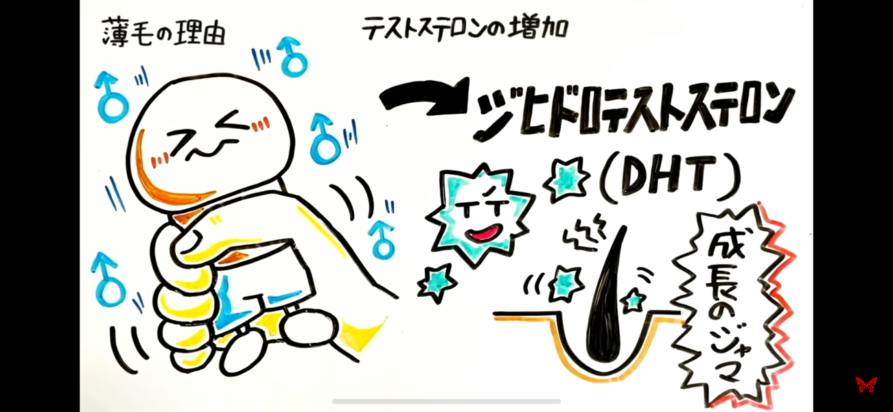 薄毛になる原因とは？